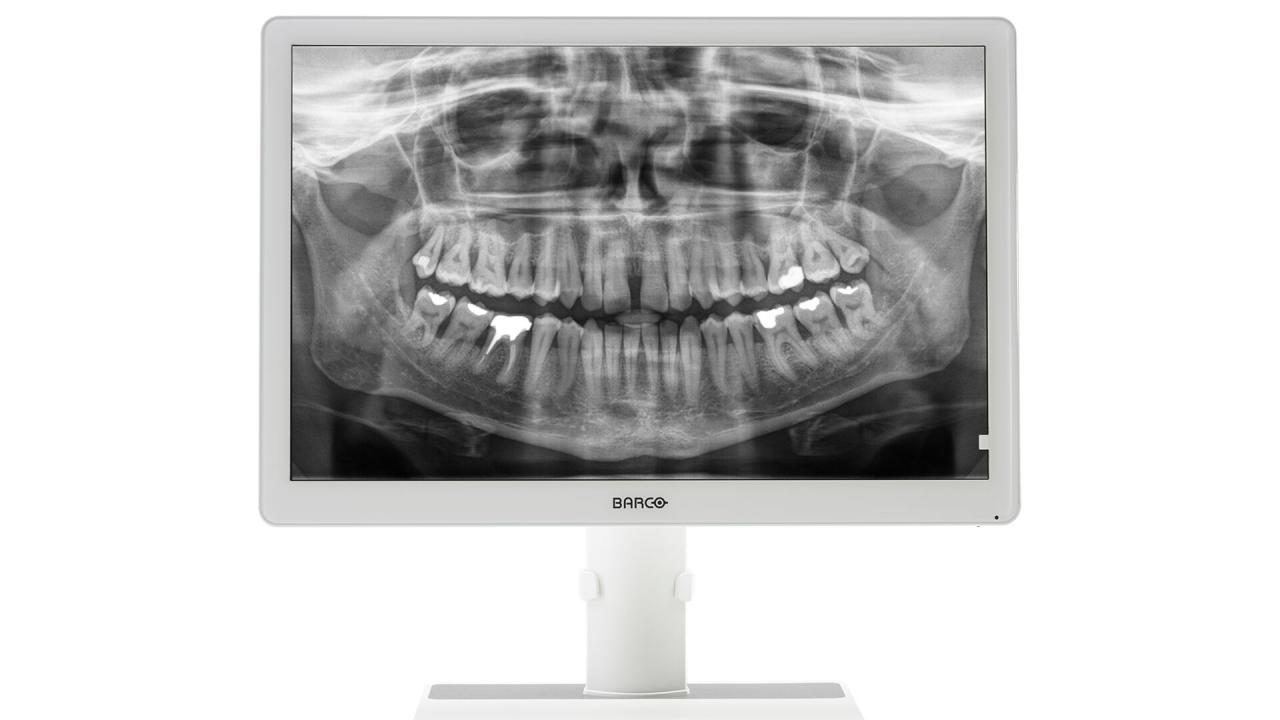 BARCO EONIS MDRC-2324 HTEW 24